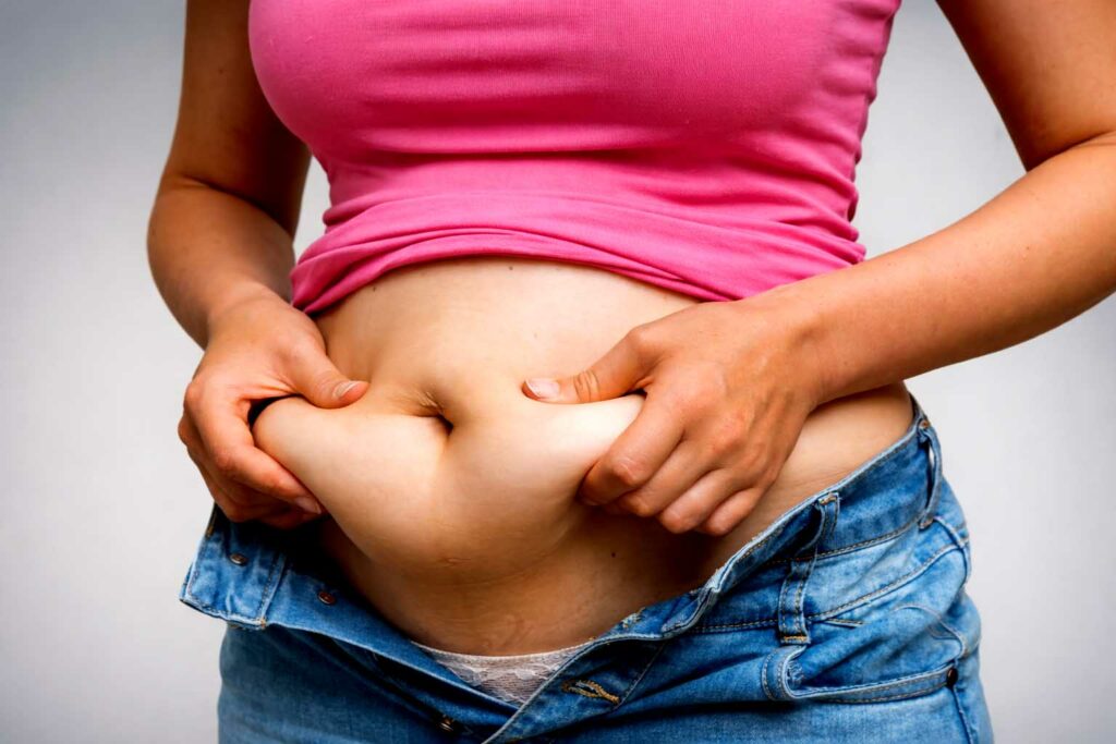 Obezita čo spúšťa tiché choroby